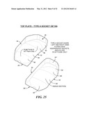 POSTERIOR SPINAL ARTHROPLASTY SYSTEM diagram and image