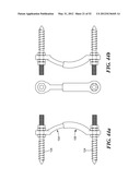 POSTERIOR SPINAL ARTHROPLASTY SYSTEM diagram and image