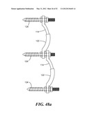 POSTERIOR SPINAL ARTHROPLASTY SYSTEM diagram and image