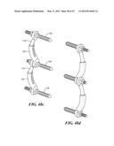 POSTERIOR SPINAL ARTHROPLASTY SYSTEM diagram and image