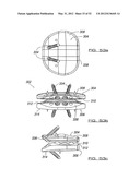 POSTERIOR SPINAL ARTHROPLASTY SYSTEM diagram and image