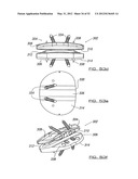 POSTERIOR SPINAL ARTHROPLASTY SYSTEM diagram and image