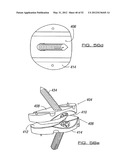 POSTERIOR SPINAL ARTHROPLASTY SYSTEM diagram and image