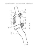 POSTERIOR SPINAL ARTHROPLASTY SYSTEM diagram and image