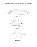 SPINAL PROSTHESIS AND FACET JOINT PROSTHESIS diagram and image