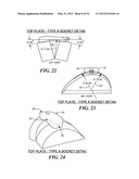 SPINAL PROSTHESIS AND FACET JOINT PROSTHESIS diagram and image