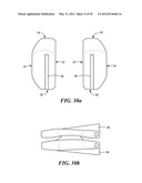 SPINAL PROSTHESIS AND FACET JOINT PROSTHESIS diagram and image