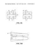 SPINAL PROSTHESIS AND FACET JOINT PROSTHESIS diagram and image