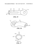 SPINAL PROSTHESIS AND FACET JOINT PROSTHESIS diagram and image