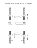 SPINAL PROSTHESIS AND FACET JOINT PROSTHESIS diagram and image