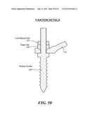 SPINAL PROSTHESIS AND FACET JOINT PROSTHESIS diagram and image