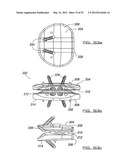 SPINAL PROSTHESIS AND FACET JOINT PROSTHESIS diagram and image