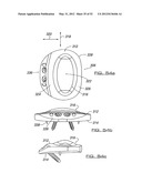 SPINAL PROSTHESIS AND FACET JOINT PROSTHESIS diagram and image