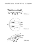 SPINAL PROSTHESIS AND FACET JOINT PROSTHESIS diagram and image