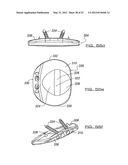 SPINAL PROSTHESIS AND FACET JOINT PROSTHESIS diagram and image