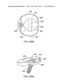 SPINAL PROSTHESIS AND FACET JOINT PROSTHESIS diagram and image