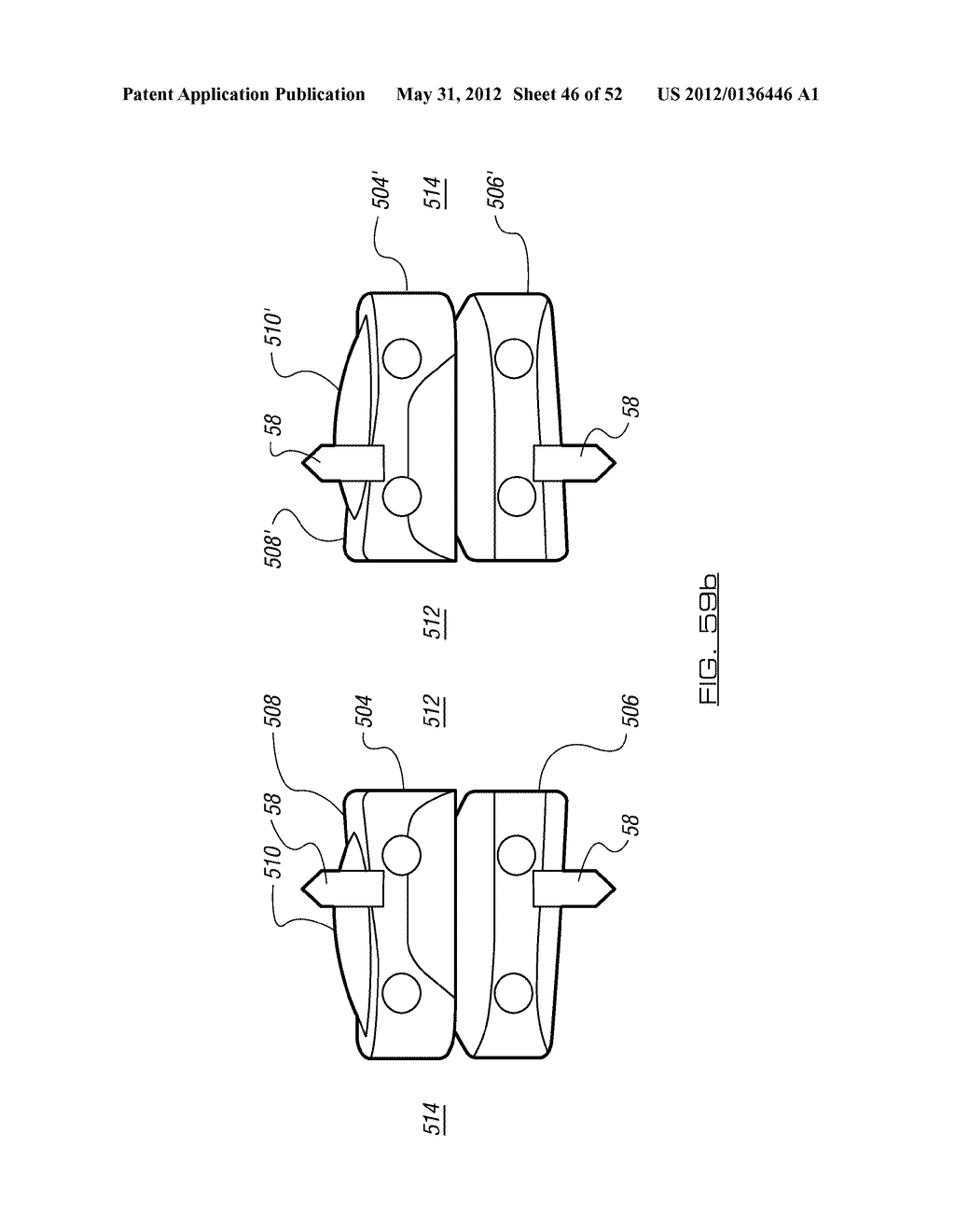 SPINAL PROSTHESIS AND FACET JOINT PROSTHESIS - diagram, schematic, and image 47