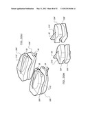 SPINAL PROSTHESIS AND FACET JOINT PROSTHESIS diagram and image