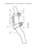 SPINAL PROSTHESIS AND FACET JOINT PROSTHESIS diagram and image