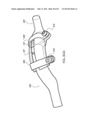 SPINAL PROSTHESIS AND FACET JOINT PROSTHESIS diagram and image