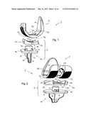 KNEE JOINT PROSTHESIS AND RELATED METHOD diagram and image