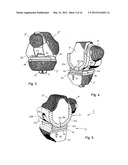 KNEE JOINT PROSTHESIS AND RELATED METHOD diagram and image