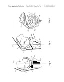 KNEE JOINT PROSTHESIS AND RELATED METHOD diagram and image