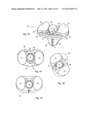 KNEE JOINT PROSTHESIS AND RELATED METHOD diagram and image