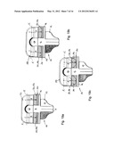 KNEE JOINT PROSTHESIS AND RELATED METHOD diagram and image