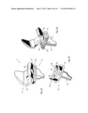 KNEE JOINT PROSTHESIS AND RELATED METHOD diagram and image