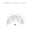 PEEL-AWAY MEMBRANE STACK FOR POSTERIOR SURFACE OF A LENS diagram and image