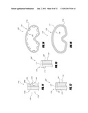 PEEL-AWAY MEMBRANE STACK FOR POSTERIOR SURFACE OF A LENS diagram and image