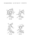 DEVICE FOR SECURING ROPE IN MULTIPLE CONFIGURATIONS AND PROCESS OF USING     THE SAME diagram and image