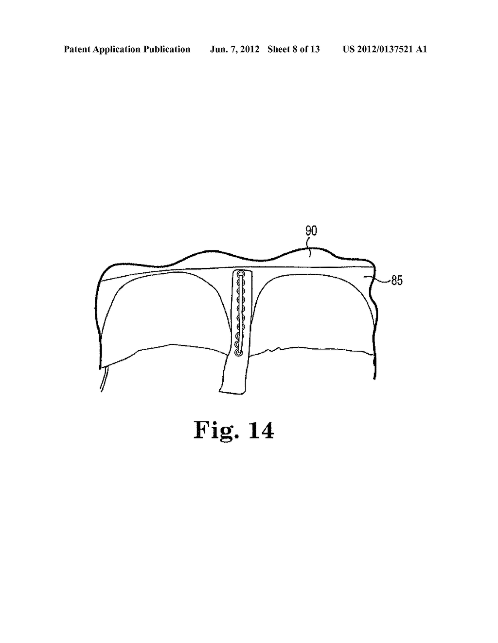 PROSTHETIC HEART VALVE, PROSTHETIC HEART VALVE ASSEMBLY AND METHOD FOR     MAKING SAME - diagram, schematic, and image 09