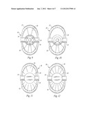 ADJUSTABLE ROTATING BLADE ASSEMBLY FOOD PREPARATION DEVICE diagram and image