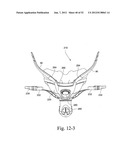 MASK SYSTEM diagram and image