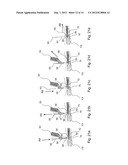 DILATOR ASSEMBLY, A DEVICE FOR FACILITATING TRACHEOSTOMY AND METHODS OF     MAKING A PERCUTANEOUS TRACHEOSTOMA diagram and image