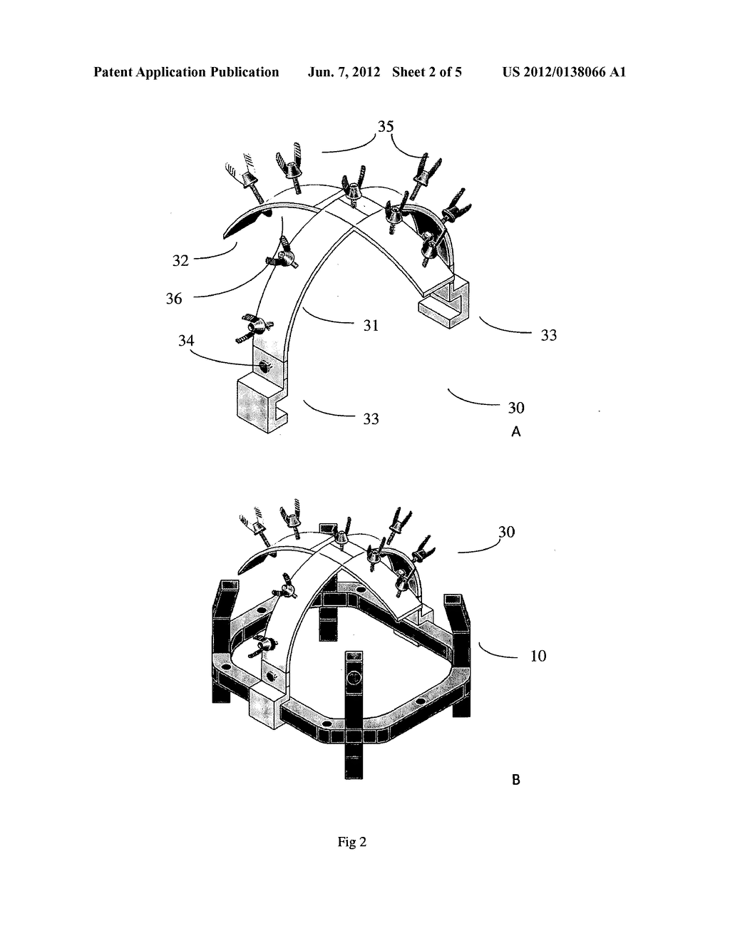 DEVICES AND METHODS FOR POSITIONING A STEREOTACTIC FRAME - diagram, schematic, and image 03