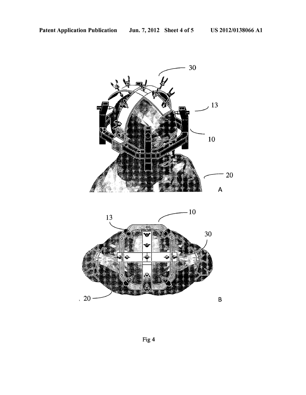 DEVICES AND METHODS FOR POSITIONING A STEREOTACTIC FRAME - diagram, schematic, and image 05