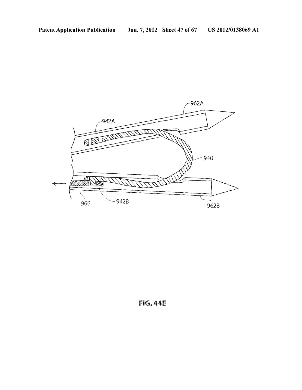 SYSTEMS AND METHODS FOR TREATMENT OF SLEEP APNEA - diagram, schematic, and image 48