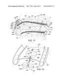 TONGUE RETAINER diagram and image