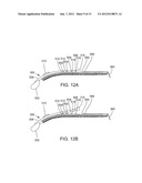 TONGUE RETAINER diagram and image