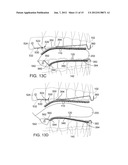 TONGUE RETAINER diagram and image