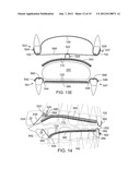 TONGUE RETAINER diagram and image