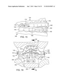 TONGUE RETAINER diagram and image