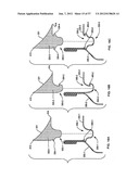 BEVERAGE CAN MARKETING DEVICE diagram and image