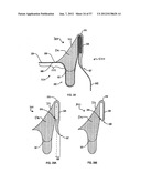 BEVERAGE CAN MARKETING DEVICE diagram and image