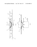 Dislocation Engineering Using a Scanned Laser diagram and image