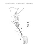 APPARATUS FOR PUSHING A FASTENER FROM A HOST MATERIAL diagram and image