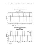 Protection of a Medical Device Against RFID-Associated Electromagnetic     Interference Like an Automobile Keyless Entry System Having an RFID     Interrogator diagram and image